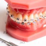 Exploring the Benefits of Different Dental Insurance Plans: A Guide for Employers