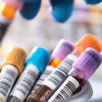clinical trial