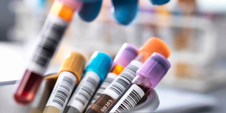 Informed Consent in Clinical Trials: Why It Matters for Participants and Progress